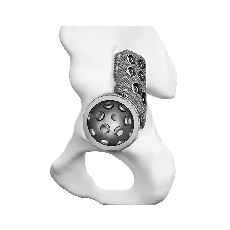 Porous Tantalum Hip Joint Augment I