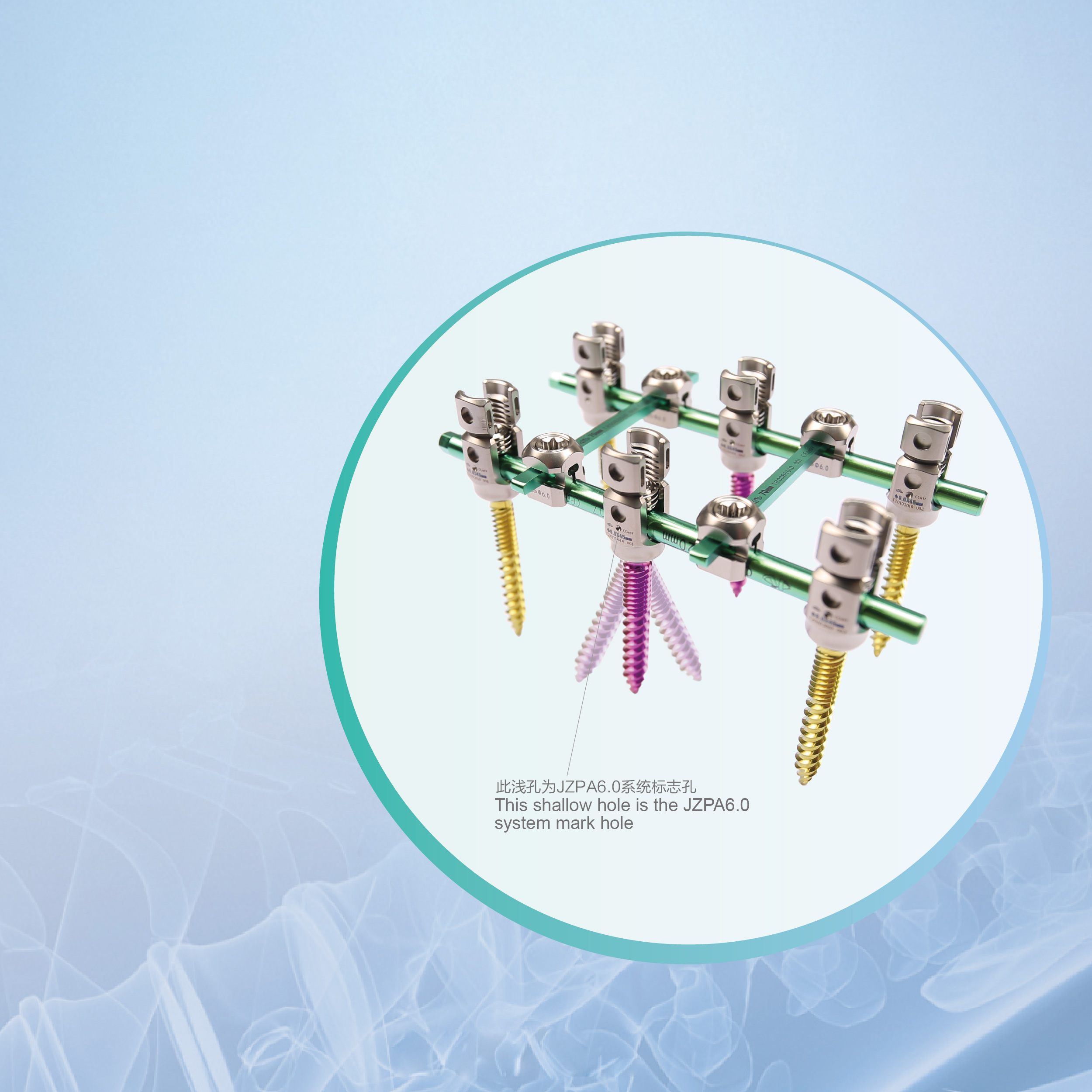 Forticore 6.0 Spinal Fixation System